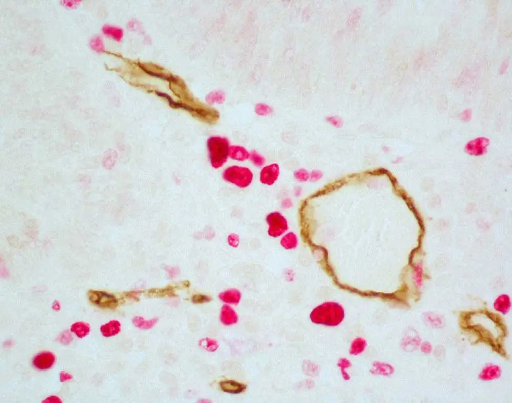 4 Colon ImmPress 1000x786 1
