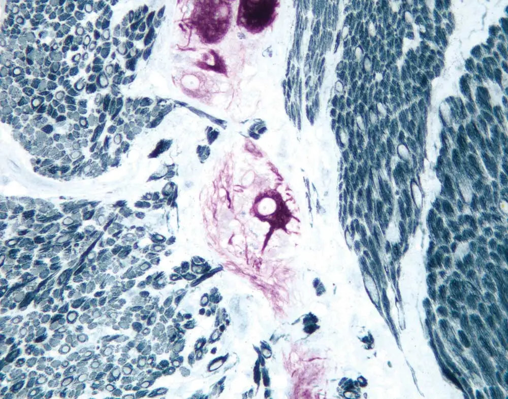 4 SmallBowel 1000x786
