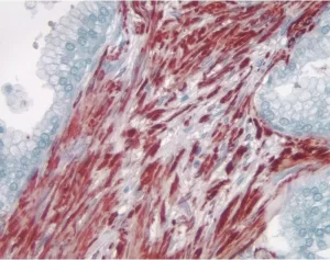 Prostate: Smooth muscle actin (m), ImmPRESS Anti-Mouse Ig Kit, AEC Substrate Kit (red). Hematoxylin QS counterstain (blue). Mounted in VectaMount AQ Mounting Medium.