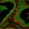 Prostate: Prostate Specific Antigen (rp), fluorescein labeled using the ProtOn Fluorescein Labeling Kit. Propidium Iodide counterstain (red). Mounted in VECTASHIELD HardSet Mounting Medium.