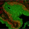 Prostate: Prostate Specific Antigen (rp), fluorescein labeled using the ProtOn Fluorescein Labeling Kit. Propidium Iodide counterstain (red). Mounted in VECTASHIELD HardSet Mounting Medium.
