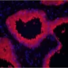 Prostate: Prostate Specific Antigen (rp) labeled with fluorescein using the ProtOn Fluorescein Labeling Kit. Fluorescein label detected with Alkaline Phosphatase Anti-Fluorescein and visualized with Vector Red. Mounted in VECTASHIELD HardSet Mounting Medi