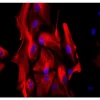 Astrocytes: Stained for GFAP and detected with Dylight 549 labeled secondary antibody. Mounted in VECTASHIELD HardSet Mounting Medium with DAPI. Image courtesy of Dr Emma East, Department of Life Sciences, The Open University, U.K.*