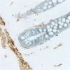 Intestine (double label): Desmin (brown, ImmPACT DAB). Cytokeratin (blue/gray, Vector SG).