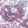 Tonsil (double label): T cells (purple, Vector VIP). Ki67 (gray/back, DAB/Ni).