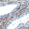 Prostate: Desmin (m), VECTASTAIN Universal Quick Kit, ImmPACT DAB (brown) substrate. Hematoxylin QS (blue) counterstain.
