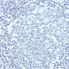 Lymph Node: With pH 9.0 Antigen Unmasking Solution, Cyclin D1 (rm), ImmPRESS Anti-Rabbit Ig Kit, DAB (brown) substrate. Hematoxylin QS (blue) counterstain.