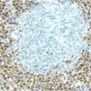 Lymph Node: With pH 9.0 Antigen Unmasking Solution, Cyclin D1 (rm), ImmPRESS Anti-Rabbit Ig Kit, DAB (brown) substrate. Hematoxylin QS (blue) counterstain.