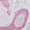 Lung: aSMA (mouse mab), ImmPRESS-AP Anti-Mouse Ig, ImmPACT Vector Red Substrate. Image kindly provided by the Centre for Inflammation and Tissue Repair, University College London.