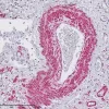 Lung: aSMA (mouse mab), ImmPRESS-AP Anti-Mouse Ig, ImmPACT Vector Red Substrate. Image kindly provided by the Centre for Inflammation and Tissue Repair, University College London.