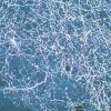 Corticostriatal fibers of rat brain stained using Vector SG substrate viewed under darkfield microscopy.