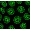 Colon: Cytokeratin detected with VectaFluor Excel Amplified Kit, Anti-Rabbit IgG, DyLight 488 (green). Mounted in VECTASHIELD® HardSet™ Antifade Mounting Medium.