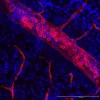 VECTASHIELD® HardSet™ Antifade Mounting Medium with DAPI