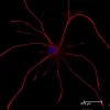Astrocytes: Stained for GFAP and detected with Dylight 488 labeled secondary antibody. Mounted in VECTASHIELD HardSet Mounting Medium with DAPI. Image courtesy of Dr Emma East, Department of Life Sciences, The Open University, U.K.*