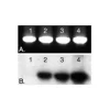 5' EndTag™ DNA/RNA Labeling Kit