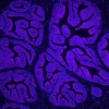 FFPE human prostate stained with Glysite Scout Glycan Screening Kit, Immunofluorescence 649 (GSK-1000, purple), showing B-PHA-L staining. Nuclear detail was visualized by DAPI staining (blue).
