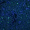 FFPE human prostate stained with Glysite Scout Glycan Screening Kit, Immunofluorescence 488 (GSK-3000, green), showing B-GNL staining.  Nuclear detail was visualized by DAPI staining (blue).