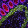 Human Colon: Rabbit Anti-Cytokeratin (AE1/AE3) and Mouse Anti-Desmin detected simultaneously with VectaFluor Duet Double Labeling Kit (DK-8828); Dylight 488 (green)/Dylight 594 (red). Mounted in VECTASHIELD PLUS with DAPI (nuclei, blue).