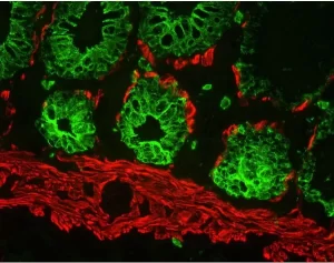 Colon (frozen, double label): Multi-Cytokeratin (m), MOM Fluorescein Kit (green); Desmin (m), MOM Basic Kit, Texas Red Avidin DCS (red).