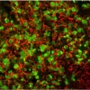 Tonsil (frozen, double label): Ki67 (m), MOM Fluorescein Kit (green); CD20 (m), MOM Basic Kit, Texas Red Avidin DCS (red).