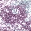 Tonsil (double label): CD3 (m), ImmPRESS Anti-Mouse Ig Reagent, Vector VIP substrate (purple); Ki67 (m), ImmPRESS Anti-Mouse Ig Reagent, Vector SG substrate (blue/gray).