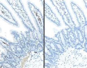 M.O.M.® (Mouse on Mouse) ImmPRESS® Polymer Reagent, Anti-Mouse IgG, Peroxidase