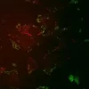 CARS and TPF imaging of Huh-7 cells transfected with FL- HCV RNA. More in "Additional Info". Courtesy of Jennifer Haley, Sylvie Belanger, Adrian Pegoraro, Albert Stolow, and John P. Pezacki, The Steacie Inst. for Molecular Sciences, NRCC, Canada.