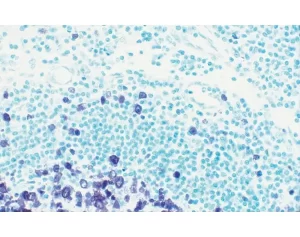Tonsil section showing specific cell staining (purple, Vector VIP) with Vector Methyl Green (green) counterstain.