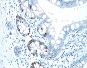 Small Bowel: Ki67 antigen stained using VECTASTAIN Elite ABC Kit and Vector DAB (brown) substrate. Hematoxylin QS (blue) counterstain.