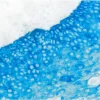 Tonsil: Cytokeratin (AE1/AE3 (m), ImmPRESS-AP Reagent, Vector Blue AP Substrate (blue).