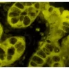 Colon: AE1/AE3 (m), ImmPRESS-AP Anti-Mouse IgG Kit, BCIP/NBT (indigo), viewed under fluorescence microscopy.