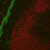 Colon: Mouse Anti-Desmin and Rabbit (monoclonal) Anti-CD3 detected simultaneously with VectaFluor Duet Immunofluorescence Double Labeling Kit, DyLight 488 Anti-Mouse (green)/DyLight 594 Anti-Rabbit (red). Mounted in VECTASHIELD HardSet Mounting Medium.
