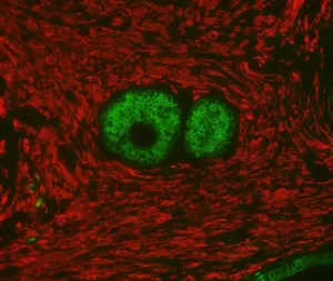 Prostate: Rabbit Anti-PSA MAb and Mouse Anti-Smooth Muscle Actin detected simultaneously with VectaFluor Duet Immunofluorescence Double Labeling Kit, DyLight 488 Anti-Rabbit (green)/DyLight 594 Anti-Mouse (red). Mounted in VECTASHIELD HardSet Mounting M