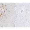 Left: Cat brain stained with mouse antibody against GFAP and detected with ImmPRESS VR HRP Anti-Mosue IgG and ImmPACT DAB Substrate. Counterstainedwith Vector Hematoxylin QS. Right: No mouse primary antibody negative control section displaying no back