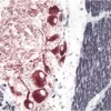 Small Bowel (double label): Peripherin (m), ImmPRESS Anti-Mouse Ig Kit, Vector NovaRED (red) substrate. Desmin (m), ImmPRESS Anti-Mouse Ig Kit, DAB/Ni (black) substrate.