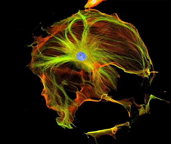 Mouse embryonic fibroblast stained with mouse anti-tubulin followed by fluorescein horse anti-mouse IgG and mounted in VECTASHIELD HardSet Mounting Medium with DAPI and TRITC-Phalloidin.