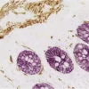 Intestine (double label): Desmin (m), VECTASTAIN Elite ABC Kit, ImmPACT DAB (brown) substrate. Cytokeratin (m) VECTASTAIN Elite ABC Kit, Vector VIP (purple) substrate.