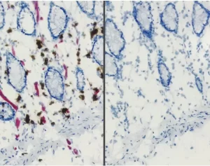 Endogenous alkaline phosphatase (AP) and peroxidase (HRP) activities in frozen intestine revealed with Vector Red AP Substrate (red) and ImmPACT DAB HRP Substrate (brown) (left). Same substrates used on BLOXALL Solution-treated tissue (right). BLOXALL B