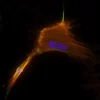 Mouse embryonal fibroblasts: Anti-Cytokeratin (m) detected with DyLight 488 Anti-Mouse IgG, mounted in a 1:1 mixture of VECTASHIELD HardSet Mounting Medium with DAPI and VECTASHIELD HardSet Mounting Medium with TRITC-Phalloidin.