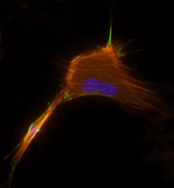 Mouse embryonal fibroblasts: Anti-Cytokeratin (m) detected with DyLight 488 Anti-Mouse IgG, mounted in a 1:1 mixture of VECTASHIELD HardSet Mounting Medium with DAPI and VECTASHIELD HardSet Mounting Medium with TRITC-Phalloidin.