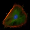 Mouse embryonal fibroblasts: Anti-Cytokeratin (m) detected with DyLight 488 Anti-Mouse IgG, mounted in a 1:1 mixture of VECTASHIELD HardSet Mounting Medium with DAPI and VECTASHIELD HardSet Mounting Medium with TRITC-Phalloidin.