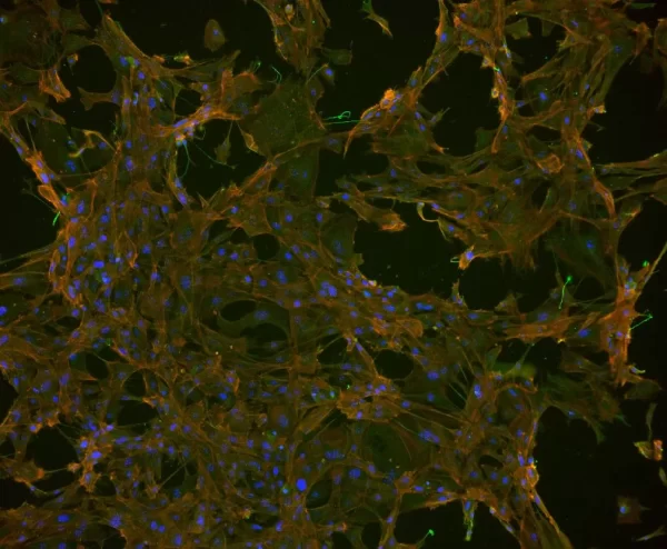 Mouse embryonal fibroblasts: Anti-Cytokeratin (m) detected with DyLight 488 Anti-Mouse IgG, mounted in a 1:1 mixture of VECTASHIELD HardSet Mounting Medium with DAPI and VECTASHIELD HardSet Mounting Medium with TRITC-Phalloidin.