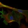 Mouse embryonal fibroblasts: Anti-Cytokeratin (m) detected with DyLight 488 Anti-Mouse IgG, mounted in a 1:1 mixture of VECTASHIELD HardSet Mounting Medium with DAPI and VECTASHIELD HardSet Mounting Medium with TRITC-Phalloidin.
