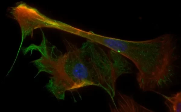 Mouse embryonal fibroblasts: Anti-Cytokeratin (m) detected with DyLight 488 Anti-Mouse IgG, mounted in a 1:1 mixture of VECTASHIELD HardSet Mounting Medium with DAPI and VECTASHIELD HardSet Mounting Medium with TRITC-Phalloidin.