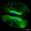 Astrocytes: Stained for GFAP and detected with Dylight 488 labeled secondary antibody. Mounted in VECTASHIELD HardSet Mounting Medium with DAPI. Image courtesy of Dr Emma East, Department of Life Sciences, The Open University, U.K.*