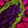 Colon: Rabbit Anti-Cytokeratin (AE1/AE3) and Mouse Anti-Desmin detected simultaneously with VectaFluor Duet Double Labelling Kit (DK-8828); Dylight 488 Anti-Mouse (green)/Dylight 594 Anti-Rabbit (red). Vasculature detected using Dylight 649 UEA I lecti