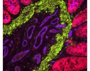 Colon: Rabbit Anti-Cytokeratin (AE1/AE3) and Mouse Anti-Desmin detected simultaneously with VectaFluor Duet Double Labelling Kit (DK-8828); Dylight 488 Anti-Mouse (green)/Dylight 594 Anti-Rabbit (red). Vasculature detected using Dylight 649 UEA I lecti