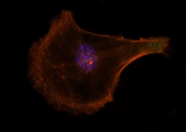 Mouse embryonal fibroblasts: Anti-Cytokeratin (m) detected with DyLight 488 Anti-Mouse IgG, mounted in a 1:1 mixture of VECTASHIELD HardSet Mounting Medium with DAPI and VECTASHIELD HardSet Mounting Medium with TRITC-Phalloidin.