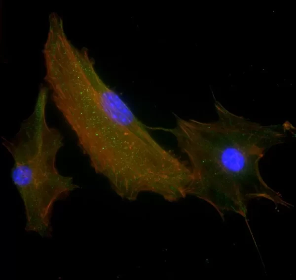 Mouse embryonic fibroblast stained with mouse anti-tubulin followed by fluorescein horse anti-mouse IgG and mounted in VECTASHIELD HardSet Mounting Medium with DAPI and TRITC-Phalloidin.