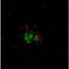 Alzheimer's disease mouse brain model - double label: glial cells stained with Iba1 (rp) followed by DyLight 594 Goat Anti-Rabbit IgG (DI-1594); plaques stained with Biotinylated Mouse Anti-Human Amyloid Beta followed by DyLight 488 Streptavidin (SA-5488)